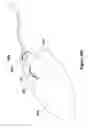 Fig. 16 - Mouse-based user interface device employing user-removable modules