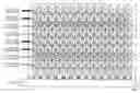 Fig. 01 - Solid state imaging device with increased vertical resolution in interlace scanning method