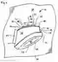 Fig. 03 - Eye target apparatus