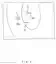 Fig. 09 - Apparatus for measuring anterior ocular segment