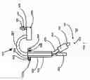 Fig. 14 - Aerosol particle analyzer for measuring the amount of analyte in airborne particles