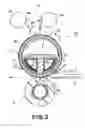 Fig. 03 - Induction heating for image flexing with means for adjusting magnetic flux