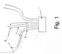 Fig. 02 - Method and device for anchoring a pipeline