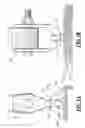 Fig. 04 - Cushioned banding anchor