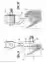 Fig. 06 - Cushioned banding anchor