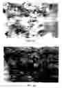 Fig. 06 - Methods of treating parkinson's disease using viral vectors
