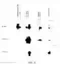 Fig. 07 - Methods of treating parkinson's disease using viral vectors