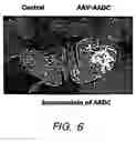 Fig. 08 - Methods of treating parkinson's disease using viral vectors