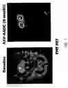 Fig. 09 - Methods of treating parkinson's disease using viral vectors