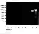 Fig. 04 - Probiotic propionibacterium