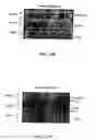 Fig. 13 - Method for screening transcriptional coregulatory proteins of transcription factors, and androgen receptor transcriptional coregulatory proteins as targets for androgen receptor-dependent diseases