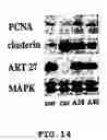 Fig. 14 - Method for screening transcriptional coregulatory proteins of transcription factors, and androgen receptor transcriptional coregulatory proteins as targets for androgen receptor-dependent diseases