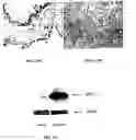 Fig. 15 - Method for screening transcriptional coregulatory proteins of transcription factors, and androgen receptor transcriptional coregulatory proteins as targets for androgen receptor-dependent diseases
