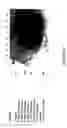 Fig. 06 - Antibody recognizing a small subset of human hematopoietic cells
