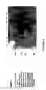 Fig. 07 - Antibody recognizing a small subset of human hematopoietic cells