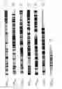 Fig. 04 - Human checkpoint kinase, hCDS1, compositions and methods