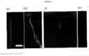 Fig. 02 - Viral fibers