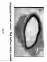 Fig. 09 - Soft tissue implants and anti-scarring agents