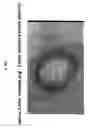 Fig. 10 - Soft tissue implants and anti-scarring agents