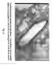 Fig. 11 - Soft tissue implants and anti-scarring agents