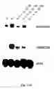 Fig. 15 - Soft tissue implants and anti-scarring agents