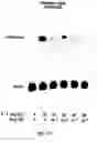 Fig. 18 - Soft tissue implants and anti-scarring agents