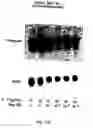 Fig. 20 - Soft tissue implants and anti-scarring agents