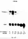 Fig. 21 - Soft tissue implants and anti-scarring agents