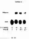 Fig. 23 - Soft tissue implants and anti-scarring agents