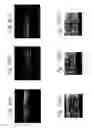 Fig. 08 - Method for forming ultrafine particle brittle material at low temperature and ultrafine particle brittle material for use therein