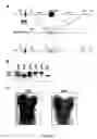 Fig. 02 - Method of treatment