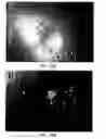 Fig. 15 - Progenitor cell preservation factors and methods for and products of their use