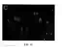 Fig. 17 - Progenitor cell preservation factors and methods for and products of their use