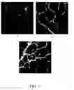 Fig. 07 - Intravascular delivery of nucleic acid