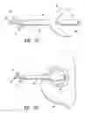 Fig. 04 - Vacuum device and method for treating tissue adjacent a body cavity