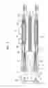 Fig. 04 - Endoscope apparatus