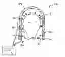Fig. 01 - Method and apparatus for noise extraction in measurements of electromagnetic activity in biological sources