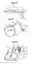 Fig. 02 - Devices, systems and methods for endocardial pressure measurement