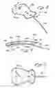 Fig. 06 - Sutureless implantable device and method for treatment of glaucoma