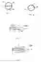 Fig. 03 - Dialysis catheter tip