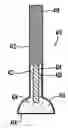 Fig. 01 - Ice pain management device and method