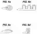 Fig. 06 - Device and method for ablation of body cavities