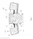 Fig. 10 - Anterior bone plate system and method of use