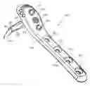 Fig. 01 - System for stabilization of fractures of convex articular bone surfaces including subchondral support structure