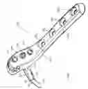 Fig. 02 - System for stabilization of fractures of convex articular bone surfaces including subchondral support structure