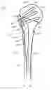 Fig. 22 - System for stabilization of fractures of convex articular bone surfaces including subchondral support structure