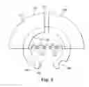 Fig. 06 - Apparatus for securing a therapy delivery device within a burr hole and method for making same