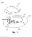 Fig. 08 - Apparatus for securing a therapy delivery device within a burr hole and method for making same