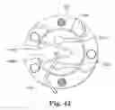 Fig. 35 - Apparatus for securing a therapy delivery device within a burr hole and method for making same
