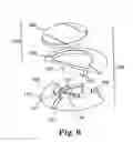 Fig. 07 - Methods and apparatus for securing a therapy delivery device within a burr hole